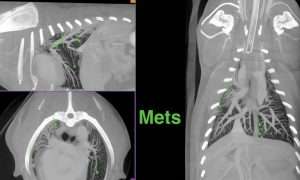 3D Lung Mets photo