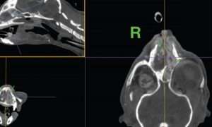 photo of a Nasal MPR