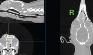 RT Nasal MPR scan